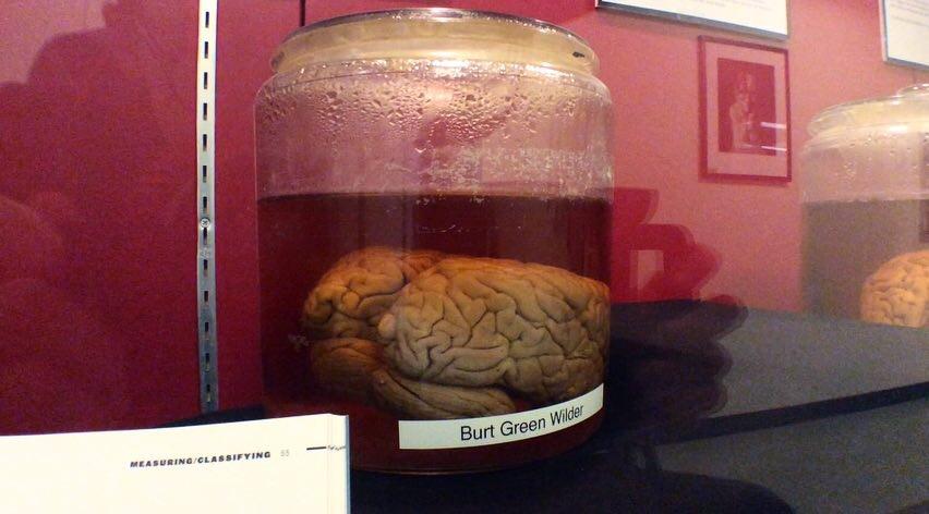 Ithacas Most Morbid Treasure The Brain Collection Of Uris Hall