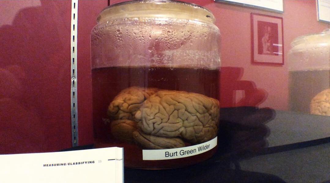 Ithaca's Most Morbid Treasure: The Brain Collection of Uris Hall